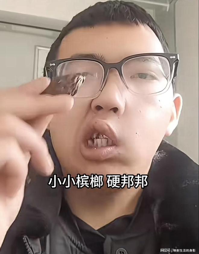 致脸部变形还边嚼边劝大家别碰槟榔k8凯发国际入口男子嚼槟榔七年导(图2)